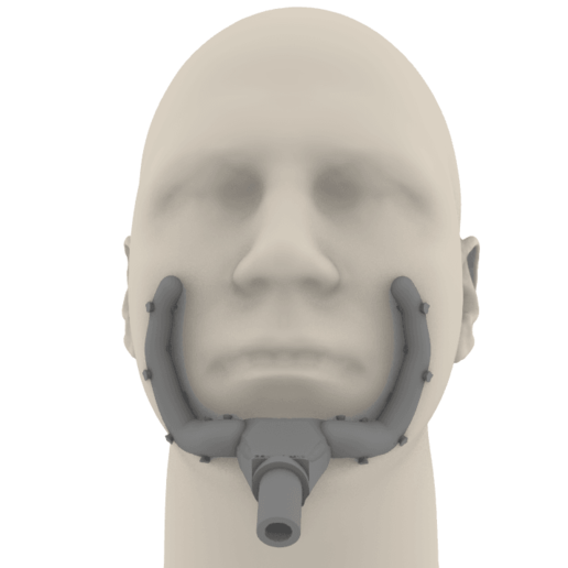 3D project Ejector Dental  - Mito3D